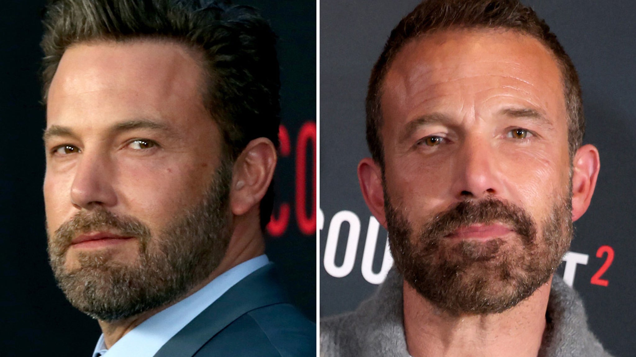 Ben Affleck -- Good Genes or Good Docs?!