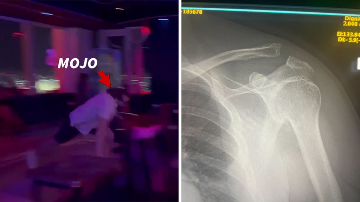 Mojo Muhtadi Suffers Gnarly Shoulder Injury In Vegas Dance Battle, on Video 042125_mojo_rawley_xray_kal