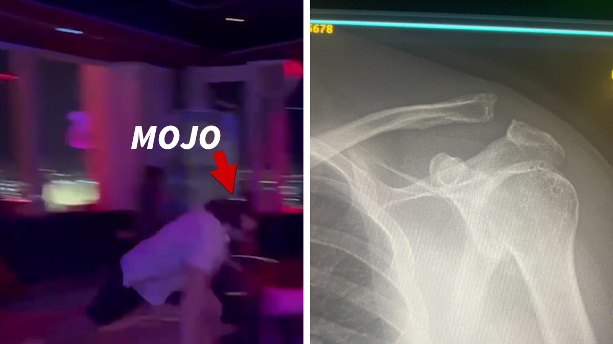 Mojo Muhtadi Suffers Gnarly Shoulder Injury In Vegas Dance Battle, on Video