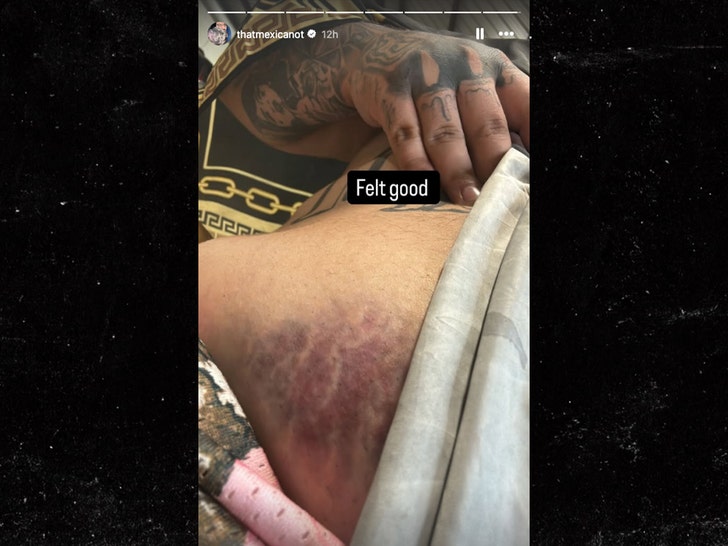 That Mexican OT bull injury insta 1