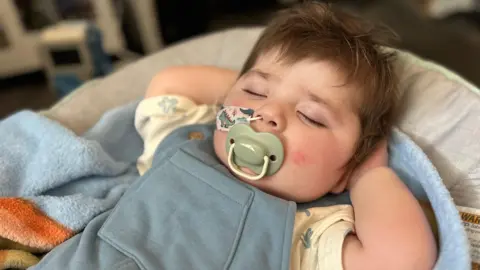 Parents' worldwide search for babies with son's rare condition Jack is asleep with his hands behind his head. He has brown hair, is in a blue baby grow and has a dummy in is mouth and a feeding tube going up his nose.