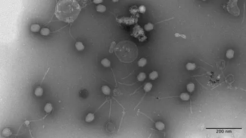 I found a bacteria-eating virus in my loo University of Southampton A grey image showing more than a dozen hexagonal shapes with a long tail attached.