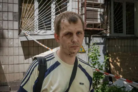 After a night of terror in Kyiv, the search for dead goes on A man in a T-shirt looks on with cuts to his face in front of a building