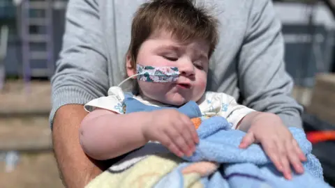 Parents' worldwide search for babies with son's rare condition Family photo Jack being held by his dad Nick. Jack is in a blue baby grow and has a feeding tube going up his nose held in place with a dinosaur sticker.