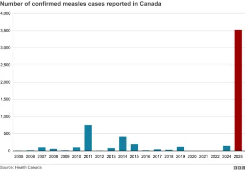 How Canada became the centre of a measles outbreak in North America A graph showing the number of confirmed measles cases in Canada over the last 10 years, with 2025 being significantly higher than previous years.