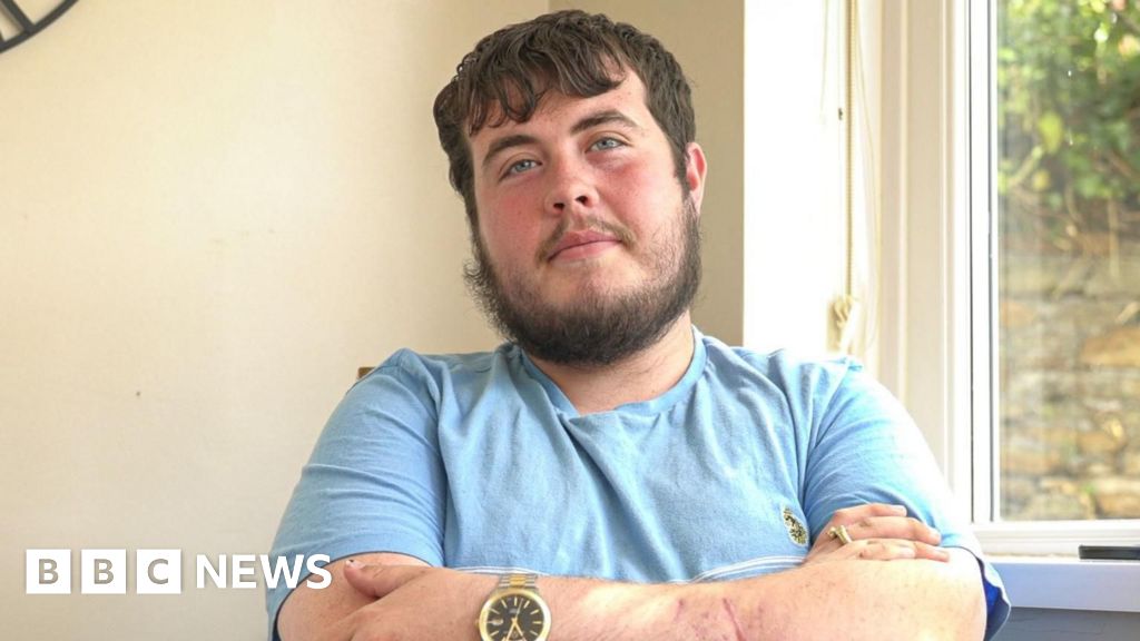 2a260240 63e5 11f0 89ea 4d6f9851f623 Cardiff man says triple dog attack has left him with nightmares