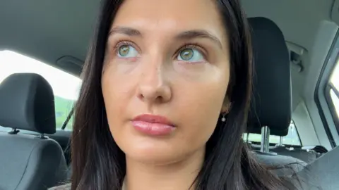 Cardiff man says triple dog attack has left him with nightmares Erin Evans Erin Evans, who has long brown hair and green eyes and has taken a selfie sitting in her car after having many operations to repair her lip. She looks away from the camera with a neutral expression
