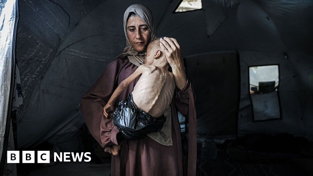9e891020 68d9 11f0 af20 030418be2ca5 The story behind the photograph of a starving Gaza baby