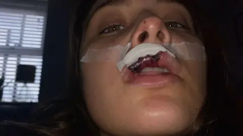 Cardiff man says triple dog attack has left him with nightmares Erin Evans Erin Evans has a plaster over her top lip where there are visible extensive injuries and bruising. She has long dark hair and is sat in a dark room with a window behind her.