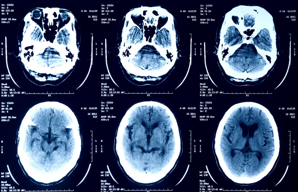 medical imagery getty scans Episource is notifying millions of people that their health data was stolen