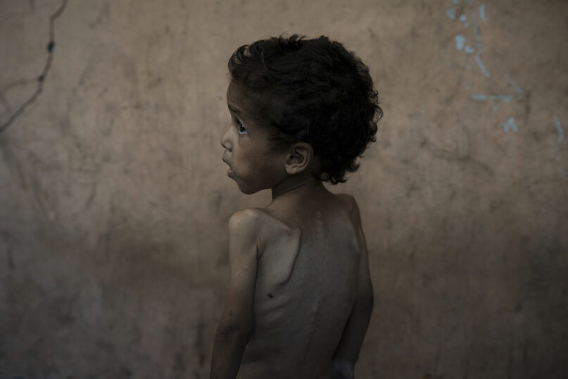 webRNS Gaza Starvation2 Many people claim to value human life. Few have the will to provide real help.