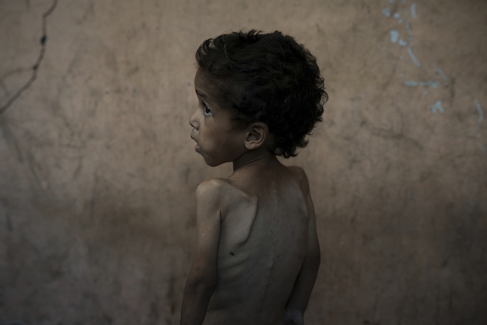 webRNS Gaza Starvation2 As Gaza starves, churches must lead on Palestinian recognition