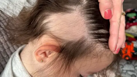 Mum's warning after Temu brush rips out child's hair Supplied A three-year-old girl sits on a grey seat, revealing a 10cm square bald patch on her scalp, surrounded by her natural brown hair. Her mother’s hand rests gently on her head, her fingernails painted a striking red.