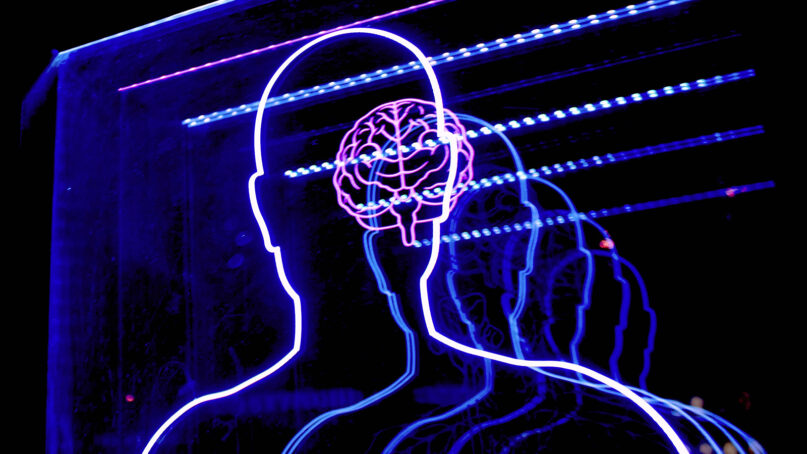 Let's stop pretending human beings are dead when they are clearly alive webRNS Brain Dementia1 071521 Let's stop pretending human beings are dead when they are clearly alive